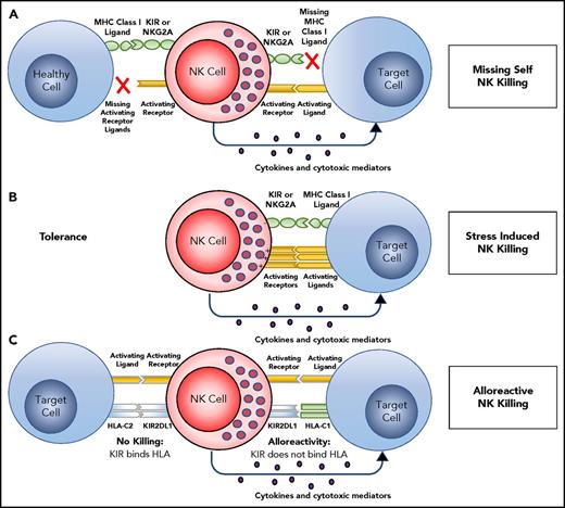 Figure 2. Target recognition, tolerance, missing self. (A) NK cells recognize and kill their targets by an integrated balance of inhibitory and activating signals to discriminate between healthy cells (tolerance) vs elimination of transformed or virally infected targets (killing). NK-cell tolerance depends on several major histocompatibility complex (MHC) class I inhibitory signals (either classical, HLA-A, -B or -C, or nonclassical, HLA-E) expressed by heathy cells that engage KIR or NKG2A with minimal activation signals resulting in tolerance. Malignant transformation or viral infection promotes target cell killing by downregulation of MHC class I expression and an upregulation of signals from activating NK-cell receptors. (B) Although in some cases, MHC downregulation is variable or incomplete, target cell killing can still occur by changing the balance with activating signals upregulated by stress-induced activating receptor ligands. (C) This balance between inhibition and activation can be uniquely manipulated in the hematopoietic transplant setting by selection of donors who will respond to apparent missing self HLA class I in the HLA-mismatched recipients. For example, reconstitution with a high frequency of donor KIR2DL1+ NK cells would not be inhibited in a HLA-C1 (C1+-HLA-C) recipient (KIR ligand mismatch). Here, NK-cell alloreactivity would kill the recipient’s tumor. In contrast, when the same KIR2DL1+ NK cells reconstitute in an HLA-C2 recipient (C2+-HLA-C) (KIR ligand match), the recipient’s tumor would be seen as having self HLA class I and would not provoke an alloreactive NK-cell response.