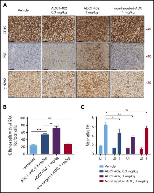 Figure 6. Pharmacodynamic studies of ADCT-402. (A) Representative scans of FFPE Ramos xenograft tumor sections, obtained from vehicle-treated control mice or mice treated with 0.3 and 1 mg/kg ADCT-402 or 1 mg/kg nontargeting ADC and stained with an anti-CD19 antibody (top), anti-PBD linker antibody (middle), or an anti-γ-H2AX antibody (bottom). (B) Histogram depicting % cells with γ-H2AX in tumor cell suspensions taken from Ramos xenograft tumors 24 hours after injection with vehicle or 0.3 or 1 mg/kg ADCT-402 or 1 mg/kg nontargeted ADC. Data represent the mean and SD from 3 individual mice per data point. **P ≤ .01, ***P ≤ .001. (C) Histogram depicting mean OTM in irradiated (I) or unirradiated (UI) tumor cell suspensions taken from Ramos xenograft tumors 24 hours after injection with vehicle or 0.3 mg/kg or 1 mg/kg ADCT-402 or 1 mg/kg nontargeted ADC. Data represent the mean and SD from 3 individual mice per data point. Statistical analysis was done with unpaired t test with Welch correction (not assuming equal SDs). P values are 2-tailed; *P ≤ .05, **P ≤ .01. SD, standard deviation.