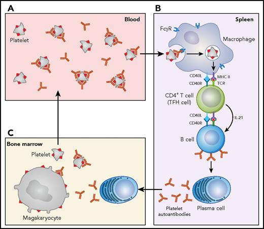 Figure 1. The spleen in the pathogenesis of ITP. (A) Autoantibodies bind to antigens on platelets, primarily gpIIb/IIIa, and gpIb/IX. (B) Splenic macrophages expressing FcγR internalize antibody-coated platelets, degrade them, and present platelet glycoprotein-derived peptides to autoreactive CD4+ T cells, which on activation interact with B cells through the CD40/CD40L interaction leading to somatic hypermutation and class switching. Autoreactive B cells differentiate into anti-platelet antibody-producing plasma cells that either stay in the spleen or migrate to the blood and bone marrow. (C) Megakaryocytes in the bone marrow express platelet glycoproteins such as gpIIb/IIIa and gpIb/IX, and autoantibodies against these antigens impair platelet production and contribute to megakaryocyte apoptosis. Circulating CD8 positive can also cause thrombocytopenia by direct cytotoxicity (not shown).