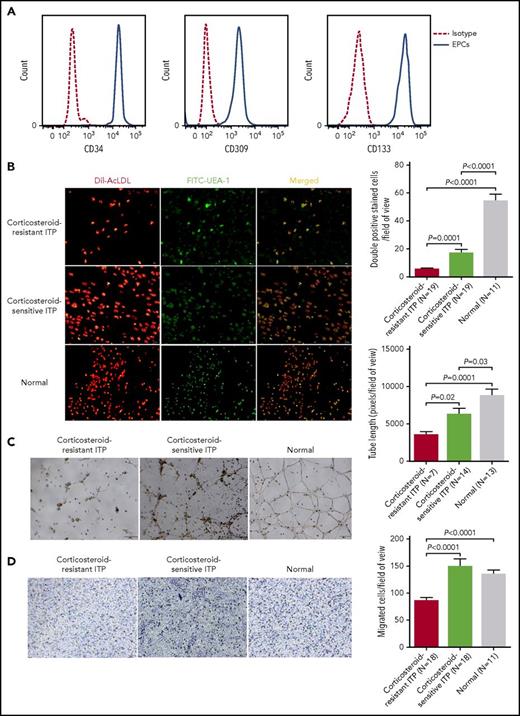 Figure 2. Characterization of cultivated BM EPCs and dysfunctional BM EPCs in corticosteroid-resistant ITP patients compared with corticosteroid-sensitive ITP patients and healthy controls. (A) The typical EPC phenotype of cultivated BM EPCs was confirmed by demonstrating the positive expression of CD34, CD309, and CD133 at day 7 in culture by flow cytometry (full line). Aliquots of isotype-identical antibodies served as negative controls (dotted line). (B) Representative images (left panel) for cultivated BM EPCs at day 7 in culture among patients with corticosteroid-resistant ITP, corticosteroid-sensitive ITP, and healthy controls (Normal). Typical BM EPCs were characterized by double-positive–stained (merged in yellow) with DiI–Ac-LDL (red) and FITC–UEA-I (green) (original magnification ×10). Quantification (right panel) of double-positive–stained cells (merged in yellow) with DiI–Ac-LDL (red) and FITC–UEA-I (green) at day 7 in culture among the corticosteroid-resistant ITP, corticosteroid-sensitive ITP, and healthy control groups (original magnification ×10). The data were expressed as the means ± SEM. (C) Tube formation was inspected on an inverted light microscope. The relative tube length per field of view was analyzed by Image Proplus by counting 3 random fields per sample. Representative images (left panel) and quantification (right panel) of tube formation (pixels of tubes per field of view) by cultivated BM EPCs at day 7 in culture (original magnification ×4). (D) The migrated cells (blue) were fixed and stained with crystal violet. Cell images were obtained on a phase-contrast microscope (Olympus) and counted in 3 random fields per sample. Representative images (left panel) and quantification (right panel) of the transwell migration assays of cultivated BM EPCs at day 7 in culture (original magnification ×10). The numbers of migrated BM EPCs per field of view were compared among patients with corticosteroid-resistant ITP, corticosteroid-sensitive ITP, and healthy controls. Three power fields were randomly counted and averaged per sample. Subject variables were compared using the Mann-Whitney U test for continuous variables. All P values <.05 were considered significant and were provided in the figure.