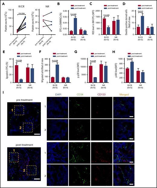Figure 7. In vivo treatment with atorvastatin and NAC improved the number and function of either precultivated or cultivated BM EPCs from corticosteroid-resistant ITP patients. The effects of atorvastatin and NAC treatment on the (A) platelet counts, (B) percentages, (C) ROS levels, (D) double-positive–stained cells (per well), (E) apoptosis rates, (F) migration, (G) p-p38, and (H) p-Akt of BM EPCs were compared pre- and posttreatment from corticosteroid-resistant ITP patients who achieved response (R) or CR (left panel) and NR (right panel). (I) Mouse anti-human CD34 (green) and rabbit anti-human CD133 (red) were incubated to identify the BM EPCs. DAPI (blue) was used to stain the nucleus. In situ histological analyses of the BMBs showed that the frequency of the double-positive–stained (merged in yellow) EPCs with CD34 (green) and CD133 (red) was increased in corticosteroid-resistant ITP patients posttreatment compared with pretreatment according to immunofluorescent staining (scale bars, 50 μm). Subject variables were compared using the Mann-Whitney U test for continuous variables. All P values <.05 were considered significant and were provided in the figure. ST, atorvastatin.