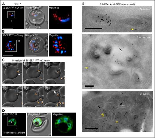 Figure 1. Dynamics and localization of PI3P in P falciparum–infected red cells. (A-B) In live P falciparum–infected red cells (3D7 strain; Pf3D7), transgenic expression of a secretory form of the PI3P-binding protein EEA1 fused to mCherry (SS-EEA1WT-mCherry; red) reveals secretory PI3P in a perinuclear region in early ring parasites (A).25 Not shown here, but as previously shown, a single-point mutant of EEA1 that fails to bind PI3P is secreted to the parasitophorous vacuole (PV),25 marked by the dotted circles in the middle panels, where the fluorescence image is merged with the bright field (B). Perinuclear localization is also seen in later schizont stages. The boxed regions in the left-hand panels are magnified in the right-hand panels. (C) Time-lapse images of the parasite’s extracellular merozoite stage (arrowhead) invading red cells to become an intracellular ring (arrow). (D) In live Pf3D7, the transgenic cytosolic form of the PI3P-binding protein EEA1 (cEEA1WT–green fluorescent protein) is seen associated with punctate vesicles and organelles of late trophozoites/schizonts (as was previously reported30) and distinct from perinuclear foci seen for SS-EEA1WT-mCherry (shown in panels A-B). The boxed region in the left-hand panel is magnified in the right-hand panel. Parasite nucleus stained with Hoechst 33242 (blue). Scale bar, 5 µm. Live cells were imaged using indicator-free RPMI1640 (Gibco) by DeltaVision Deconvolution microscopy25 with a 100×, NA-1.4 objective on an Olympus IX inverted fluorescence microscope on a temperature-controlled stage at 37°C and a Photometrics cooled custom CCD camera (CH350/LCCD) driven by DeltaVision Software from Applied Precision Inc. (Seattle, WA). (E) Cryo-IEM of PfNF54 (wild-type) parasites probed with antibodies to PI3P and secondary antibody 10-nm gold conjugate. Gold particles are detected in the apicoplast, food vacuole, and tubules (suggestive) of ER. Black arrows indicate PI3P in lumen of tubule; yellow arrows indicate cytoplasmic PI3P; double yellow arrows indicate PI3P vesicular clusters cytoplasmic to ER tubules. Experimental replicates, n = 3. Scale bar, 100 nm. Imaged in a Philips CM120 Electron Microscope (Eindhoven, The Netherlands) under 80 kV. BF, bright field; cEEA1, cytosolic form of the PI3P-binding protein EEA1; GFP, green fluorescent protein; P, parasite nucleus; R, red cell.