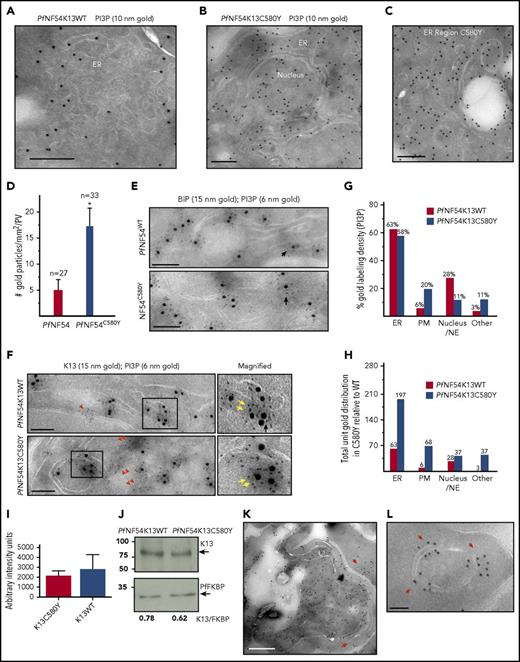 Figure 5. K13C580Y, the major mutation of artemisinin resistance, amplifies PI3P tubovesicles, propagating them throughout the parasite and into the red cell. (A-B) Cryo-IEM of artemisinin-sensitive PfNF54K13WT (A) and artemisinin-resistant PfNF54K13C580Y (B) late trophozoite/schizont parasites probed for PI3P (10 nm gold). (C) Region of ER tubules/vesicles. Scale bars, 100 nm (bar sizes differ on basis of magnification). (D) Quantitation of gold particles associated per parasite vacuole for indicated numbers of parasites for each strain. (E-F) PfNF54K13WT and PfNF54K13C580Y ER dually probed for PI3P (6 nm gold) and the secretory ER marker BiP (15 nm gold) (E) or PI3P (6 nm gold) and K13 (15 nm gold) (F). Boxes in left-hand panels are shown magnified in the right-hand panels. Black arrows indicate luminal (space) PI3P; double yellow arrows indicate PI3P vesicular clusters adjacent to K13; red arrowheads indicate small PI3P clusters, and double red arrowheads indicate large PI3P clusters devoid of K13. Scale bars, 150 nm. (G-H) Stereological analyses of percentage of PI3P gold particle density in PfNF54K13WT or PfNF54K13C580Y with each strain normalized to itself (G) and comparative fraction of PI3P-gold particles in each strain (H), accounting for threefold increase in PfNF54K13C580Y in relation to PfNF54K13WT (total number of gold particles in PfNF54K13WT set to 100). (I) RNA sequence analyses for K13C580Y in PfNF54K13WT and PfNF54K13C580Y. Y-axis indicates arbitrary intensity units. (J) Western blots showing levels of K13, PfFKBP protein (a parasite cytosolic protein that serves as a loading control), and associated ratios, indicating no significant difference in levels of K13 protein expression in PfNF54K13C580Y in comparison with PfNF54K13WT. (K-L) PfNF54K13C580Y-infected red cells probed for PI3P (10 nm gold). Red arrows show PI3P at the parasite plasma and vacuolar membranes, in vesicles in the host red cell (scale bar, 500 nm) (K) and associated with “Maurer’s clefts,” intermediates in export to the red cell membrane (scale bar, 100 nm) (L). PI3P is not detected in the host in PfNF54K13WT-infected red cells. Experimental replicates, n = 2. IEM imaged in a Philips CM120 electron microscope (Eindhoven, The Netherlands) under 80 kV. PM, plasma membrane; WT, wild-type.