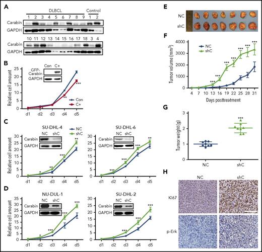 Figure 1. Carabin inhibits B-lymphoma cell proliferation. (A) Downregulated Carabin expression in DLBCL tissues. Carabin protein was analyzed in 18 DLBCL specimens, 4 benign tissues as control. Glyceraldehyde-3-phosphate dehydrogenase (GAPDH) was the immunoblot loading marker. (B) Overexpression of Carabin suppresses B-lymphoma cell proliferation. Stable expression of green fluorescent protein (GFP)-Carabin was detected by western blot (WB) in SU-DHL-6 cells. A cell growth assay was carried out over a 5-day culture period and living cells were detected by Alarma blue every 24 hours. Points, mean (n = 6); bar, standard deviation (SD); *P < .05; **P < .01; ***P < .001. Knockdown of Carabin promotes B-lymphoma cell proliferation. Knockdown of Carabin was carried out by lentivirus in (C) GCB-DLBCL cell lines, SU-DHL-4 (left), and SU-DHL-6 (right) cells; (D) ABC-DLBCL cell lines, NU-DUL-1 (left), and SU-DHL-2 (right). Cell growth assays were analyzed as described above. Points, mean (n = 6); bar, SD; *P < .05; **P < .01; ***P < .001. (E) The resected tumors from individual nude mice. Carabin knockdown and control SU-DHL-4 stable cells were injected into 2 nude mice groups, respectively. Seven mice were used in each group. (F) The tumor volume of the xenografts. Points, mean (n = 7); bar, SD; ***P < .001. (G) The tumor weight of the xenografts after dissection. Scatter plot, mean (n = 7); bars, SD; ***P < .001. (H) Immunohistochemical analysis of Ki-67 (top) and p-Erk (bottom) in the xenograft tumor tissues (hematoxylin and eosin stain; scale bar, 50 μM). C+, cells stably expressing GFP-Carabin; Con, control cell; NC, control cell; shC, cells stably expressing Carabin-specific shRNA.