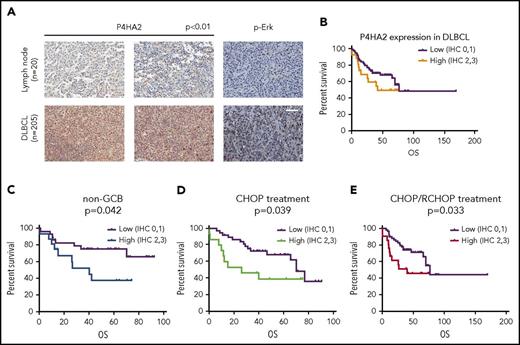 Figure 6. P4HA2 promotes DLBCL progression. (A) Upregulation of P4HA2 in DLBCL. Immunohistochemical analysis of P4HA2 and p-Erk in 205 DLBCL tissue samples and 20 reactive hyperplastic lymph node control samples. Hematoxylin and eosin stain; scale bar, 25 µM. (B) The OS with different expression levels of P4HA2 in DLBCL. Kaplan-Meier OS analysis of DLBCL based on low (n = 77) and high (n = 26) expression of P4HA2. Low, low expression of P4HA2, IHC 0-1; high, high expression of P4HA2, IHC 2-3. (C-E) Prognostic values of P4HA2 expression using Kaplan-Meier analysis. The OS of non-GCB subtype DLBCL (C), CHOP treatment (D), or CHOP/R-CHOP (E) treatment DLBCL based on different expression levels of P4HA2.