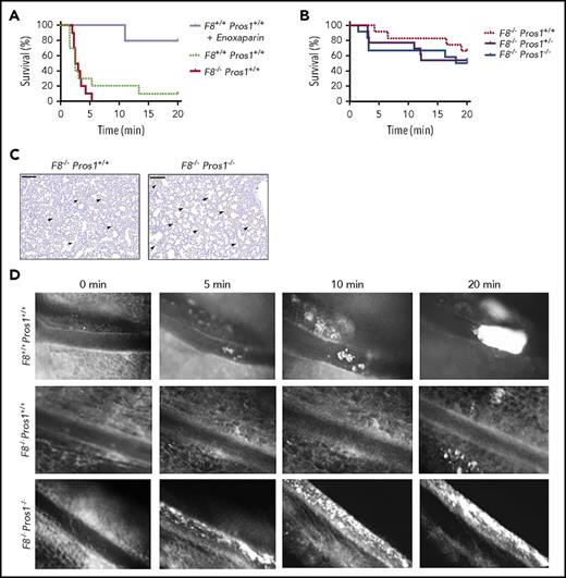 Figure 2. Murine models of thrombosis. (A-C) TF-induced venous thromboembolism in F8+/+ Pros1+/+, F8−/− Pros1+/+, F8−/− Pros1+/−, and F8−/− Pros1−/− mice (n = 10 per genotype). Anesthetized mice were injected intravenously via the inferior vena cava with different doses of recombinant TF (Innovin): 1/2 dilution (∼4.3 nM TF) in panel A and 1/4 dilution (∼2.1 nM TF) in panels B-C. In panel A, one group of F8+/+Pros1+/+ mice received an injection of the low molecular weight heparin (enoxaparin 60 µg/g s.c.). The time to onset of respiratory arrest that lasted at least 2 minutes was recorded. Experiments were terminated at 20 minutes. Kaplan-Meier survival curves (A-B). (C) Two minutes after onset of respiratory arrest or at the completion of the 20-minute observation period, lungs were excised and investigated for fibrin clots (indicated by arrowheads, immunostaining for insoluble fibrin, monoclonal antibody clone 102-10) Scale bars: 200 μm. (D) Thrombus formation in FeCl3-injured mesenteric arteries recorded by intravital microscopy in F8+/+ Pros1+/+, F8−/− Pros1+/+, and F8−/− Pros1−/− mice, representative experiment (n = 3 per genotype).