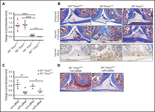 Figure 4. Acute hemarthrosis model. (A) Difference between the knee diameter 72 hours after the injury and before the injury in F8−/−Pros1+/+, F8−/−Pros1+/−, F8−/−Pros1−/−, and F8+/+Pros1+/+ mice. (B) Microscopic evaluation (Masson’s trichrome stain and immunostaining for insoluble fibrin) of the knee intra-articular space of a representative, uninjured leg and injured leg after 72 hours in F8+/+Pros1+/+, F8−/−Pros1+/+, and F8−/−Pros1−/− mice. (C) In vivo mPS silencing using specific siRNA: evaluation of the joint diameter 72 hours after injury in F8−/−Pros1+/− and F8−/−Pros1+/+ mice treated with a single intraperitoneal infusion of mPS siRNA or control siRNA. (D) Microscopic evaluation (Masson’s trichrome stain) of the knee intra-articular space of a representative injured leg after 72 hours in F8−/−Pros1+/+ mice previously treated with mPS siRNA or control siRNA. Arrowheads on Masson’s trichrome staining indicate red blood cell extravasation, whereas in the immunohistochemistry, they indicate the deposit of insoluble fibrin. Measurements are presented as means ± SEMs. *P < .05; **P < .005; ****P < .0001. ctrl, control; n.s., not significant. Scale bars: 200 μm.
