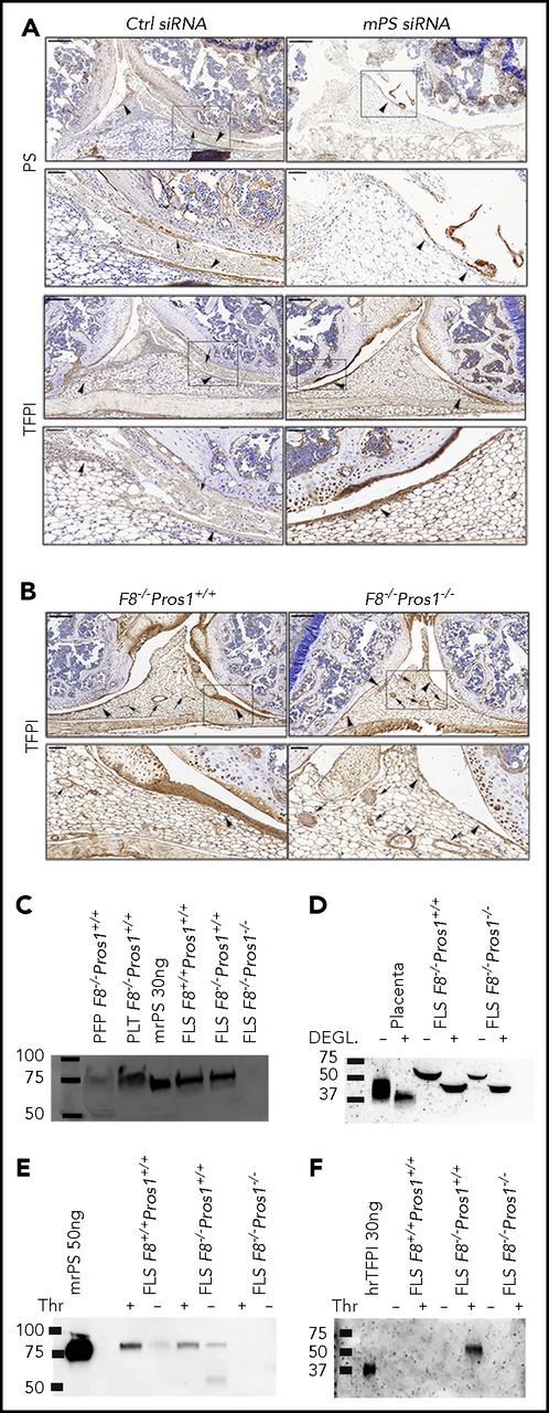 Figure 5. Both PS and TFPI are expressed in murine synovium. (A) Immunostaining for PS and TFPI in the knee intra-articular space of injured knees from F8−/−Pros1+/+ mice previously treated with control siRNA or mPS siRNA. Arrowheads point to synovial tissue and arrows to vascular structures, all positive for both PS and TFPI. The boxed areas in the upper subpanels (scale bars: 200 µm) show the area enlarged in the subpanel below (scale bars: 50 µm). (B) Immunostaining for TFPI in the knee intra-articular space of uninjured knees from F8−/−Pros1+/+ and F8−/−Pros1−/− mice. Arrowheads point to synovial tissue and arrows to vascular structures, all positive for both PS and TFPI. The boxed areas in the upper subpanels (scale bars: 200 μm) show the area enlarged in the subpanel below (scale bars: 50 μm). (C-D) Western blot analysis of conditioned media from primary murine fibroblast-like synoviocyte (FLS) cultures using anti-PS (C) and anti-TFPI (D) antibodies. Platelet-free plasma, protein lysates from platelets, and murine PS were used as positive controls (C). TFPI isoform expression was determined by comparing the molecular weights of deglycosylated TFPI and of fully glycosylated TFPI. Murine placenta was used as a positive control for TFPIα. (E-F) Western blot analysis of total protein lysates isolated from FLS after 24 hours of culture in the presence of thrombin (+) or of a vehicle (−) using anti-TFPI (E) and anti-PS (F) antibodies. Human recombinant TFPI full length was used as a positive control for TFPIα. Blots are representative of 3 independent experiments. hrTFPI, human recombinant TFPI; PLT, protein lysates from platelets; Thr, thrombin.