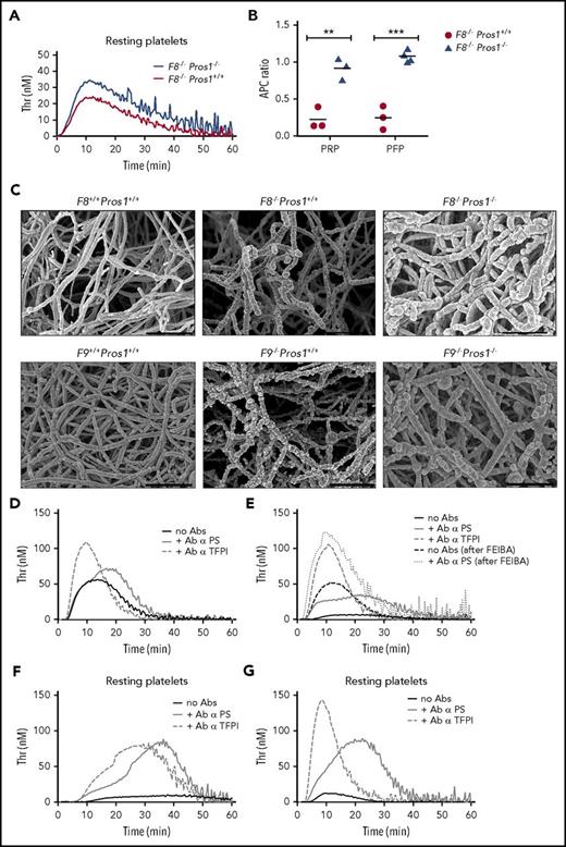 Figure 7. Thrombin generation and fibrin network in hemophilia. (A) TF-induced (1 pM) thrombin generation in PRP from F8−/− Pros1+/+ and F8−/− Pros1−/− mice depicting TFPI-dependent PS activity. (B) APC-dependent PS activity in PRP and PFP from F8−/− Pros1+/+ and F8−/− Pros1−/− mice. (C) Representative scanning electron microscopy images from F8+/+ Pros1+/+, F8−/− Pros1+/+, and F8−/− Pros1−/− fibrin structure and from F9+/+ Pros1+/+, F9−/− Pros1+/+, and F9−/− Pros1−/− fibrin structure (Scale bars: 1 μm). (D-G) Thrombin generation triggered by low TF concentration (1 pM) in PFP (D-E) and PRP (F-G) from severe HA patients (FVIII < 1%) without (D,F) and with (E,G) a high titer of inhibitor. Measurements are presented as means ± SEM. **P < .005; ***P < .0005. Ab, antibody; FEIBA, factor eight inhibitor bypassing activity.