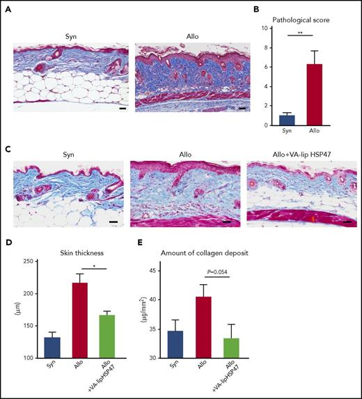 Figure 4. VA-lip HSP47 resolve established skin fibrosis in chronic GVHD. Mice were transplanted as in Figure 1. VA-lip HSP47 were intravenously injected 3 times per week from day +21 to day +41 into allogeneic recipients. Representative images of MT staining (A) and skin pathological GVHD scores (B) on day +21. (C-E) The skin samples were harvested on day +42 after BMT. (C) Representative images of MT staining. Skin thickness (D) and amount of collagen deposit (E) on day +42 in the skin of syngeneic (n = 7), allogeneic (n = 14), and allogeneic recipients treated with VA-li pHSP47 (n = 11) from 2 independent experiments were combined and are shown as means ± SEM. Scale bar, 50 µm. *P < .05; **P < .01.