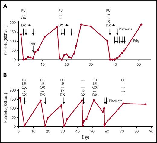 Figure 1. Clinical course of patients 1 and 2. (A-B) Medications administered during cycles of treatment are shown at the top of each panel. Dexamethasone (DX) was continued for 3 days after each episode of thrombocytopenia in patient 1 (horizontal arrows). Platelet and red blood cell (RBC) transfusions and intravenous immunoglobulin (IVIg) infusions are indicated by vertical arrows. Days (x-axis) are numbered from the first cycle of chemotherapy that was followed by an episode of thrombocytopenia. IR, irinotecan; LE, leucovorin; OX, oxaliplatin.
