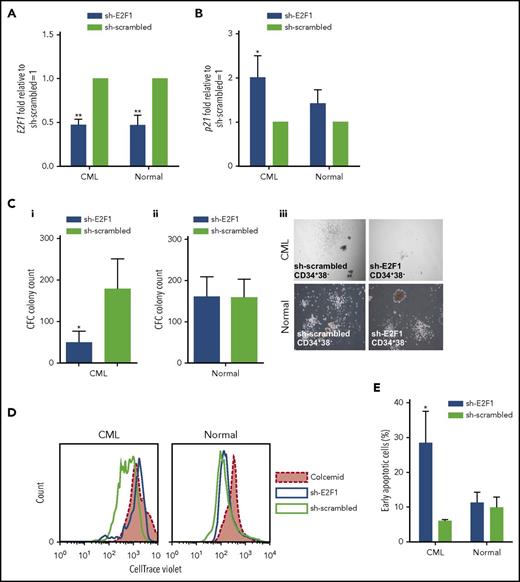 Figure 6. E2F1 knockdown induces a block in proliferation and increased cell death in CML SPCs. mRNA levels of (A) E2F1 and (B) p21 by Q-PCR in E2F1 knockdown GFP+ healthy and CML SPCs. Transfection with scrambled vector was used as negative control. (C) CFC analysis to measure colony-forming ability following E2F1 knockdown in (i) CML and (ii) healthy SPCs. (iii) Representative images for CFC from healthy and CML SPCs upon E2F1 knockdown (phase-contrast images, ×10 magnification). (D) Representative histogram of cell divisions by CellTrace Violet staining in E2F1 knockdown healthy and CML SPCs. Colcemid treatment was used to visualize undivided cells. (E) Percentage of early apoptosis indicated by Annexin V+/7-AAD− cells. Each experiment had N = 3 biological replicates. *P < .05; **P < .01.