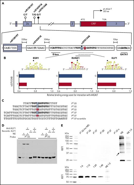 Figure 1. Presentation of the A4GALT gene, 3 candidate regulators, and gel shift assay showing no binding of KLF1 to the P1-specific rs5751348G sequence. (A) Schematic representation of A4GALT with the 3 SNPs suggested to determine the P1/P2 phenotypes. The main candidate SNP is marked with a black circle, with the others in white. Gray boxes depict noncoding exons with the open reading frame (ORF) in red and introns represented by horizontal black lines. In the lower, magnified section of exon 2a and the following intron, the P1-associated variants of each SNP and putative binding sites for selected TFs are indicated in boldface type. The main SNP (rs5751348) is highlighted in blue (P1 allele) and red (P2 allele). (B) EGR1, RUNX1, and KLF1 sequence logos showing binding preferences are adapted from the JASPAR database.25 The sequence logos for EGR1 and KLF1 are reversed to match the reading direction of A4GALT. Murine binding data are used for RUNX1 and KLF1 because data sets for the human TF are scarce (RUNX1) or not available (KLF1) in the database. For more data on RUNX1-binding requirements, see supplemental Figure 2. Bottom, 3 graphs highlighting the relative score of the binding energy for the 3 candidate TFs are displayed for both P1 and P2 alleles (G and T). The scale of the x-axis is centered around the default binding threshold of 0.8. (C) Oligonucleotides representing the sense strand in the probes used are shown with the nucleotide corresponding to rs5751348 with the P1 variant in blue and P2 in red. (D) EMSA shift and supershift reaction using P1/P2-32 probes, with nuclear extracts (NEs) from HEL cells or recombinant KLF1 and anti-KLF1. (E) Blotting with anti-KLF1 on protein pull-downs with P1 probes of various lengths, P2-37 probe and a scrambled version of the P1-37 probe. NE are shown as positive control for antibody binding and blotting of a serial dilution of recombinant KLF1 for anti-KLF1 to show appropriate detection by the antibody under the conditions used. Differences in molecular weights of KLF1 are due to an attached tag on the recombinant version of the protein.