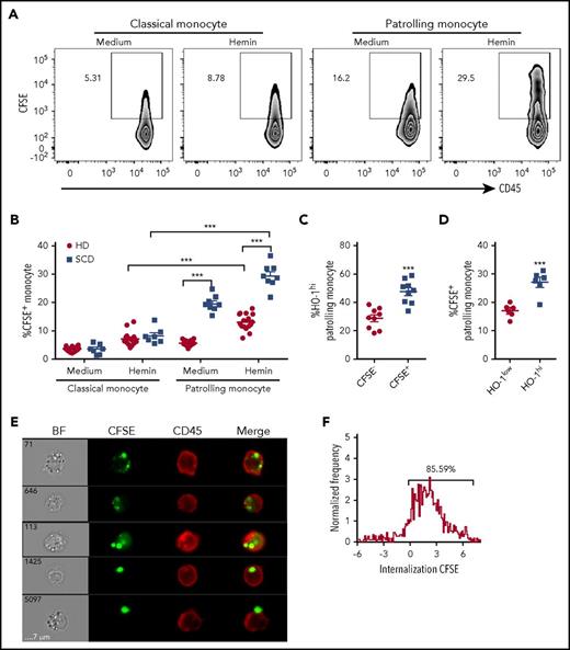 Figure 3. PMos uptake hemin-exposed HUVECs. CFSE-labeled HUVECs were pretreated without (“medium”) or with hemin (20 µM) before coculturing with purified monocytes from HDs (n = 18, filled circles) or SCD patients (n = 8, filled squares) for 4 hours. (A) Representative dot plots comparing CFSE+ classical and PMos. (B) Frequencies of CFSE+ classical and PMos are shown. (C) Frequencies of HO-1hi–expressing cells in PMos from HDs (n = 9) comparing CFSE− (no attachment/uptake of CFSE+ cellular material) and CFSE+ (representing cells that have adhered to/taken up CFSE+ cellular material) subpopulations following coculture with labeled hemin-treated HUVECs. (D) Comparison of frequencies of CFSE+ PMos from SCD patients (n = 6) in HO-1low vs HO-1hi subpopulations following coculture with HUVECs. (E) Representative flow cytometry images acquired simultaneously and gated on CFSE+ patrolling CD14lowCD16+ monocytes from SCD patients (from panel A). Right to left: single-channel bright field (BF), CFSE (representing HUVEC material in green), CD45 (representing PMos in red), and merged images showing CFSE+ materials within CD45+ cells in the first 4 rows, but not in the last row where CFSE+ material is attached to the external surface of PMo. (F) Histogram depicting degree of CFSE+ material internalized within PMos with internalization score: <0 represents CFSE+ material attached to the surface of PMos; >0 represents CFSE+ material internalized by PMo. Percentage of cells with internalization score of >0 is indicated. Data represent mean ± SEM; means were compared using 2-tailed paired Student t test (medium vs hemin treatment as well as monocyte subset vs other monocyte subset in the same donor/patient) and unpaired Student t tests (HD vs SCD patients). ***P < .001.