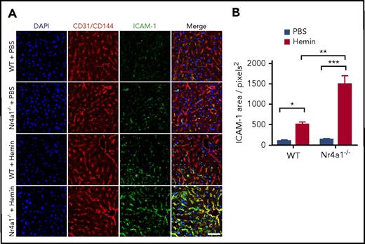 Figure 6. Hemin induces higher vascular ICAM-1 expression in Nr4a1−/− mice. WT mice and Nr4a1−/− mice were injected with hemin (30 μmol/kg mouse) or phosphate-buffered saline (PBS). (A) Whole mount immunofluorescence analysis of livers 24 hours postinjection showing ICAM-1 (green), CD31/CD144 (red), and 4′,6-diamidino-2-phenylindole (DAPI) (blue). Scale bar = 50 µm. Yellow in “Merge” images indicates colocalization of ICAM-1 (green) expression on CD31/CD144+ ECs (red). A pronounced increase in ICAM1 expression was evident due to hemin injection in Nr4a1−/− mice. (B) Quantification of the area of blood vessels expressing ICAM-1 in the Nr4a1−/− and control groups using Image J software. Data represent mean ± SEM; means were compared using 2-tailed Student t test. *P < .05; **P < .01; ***P < .001 (n = 6-8 mice per group).