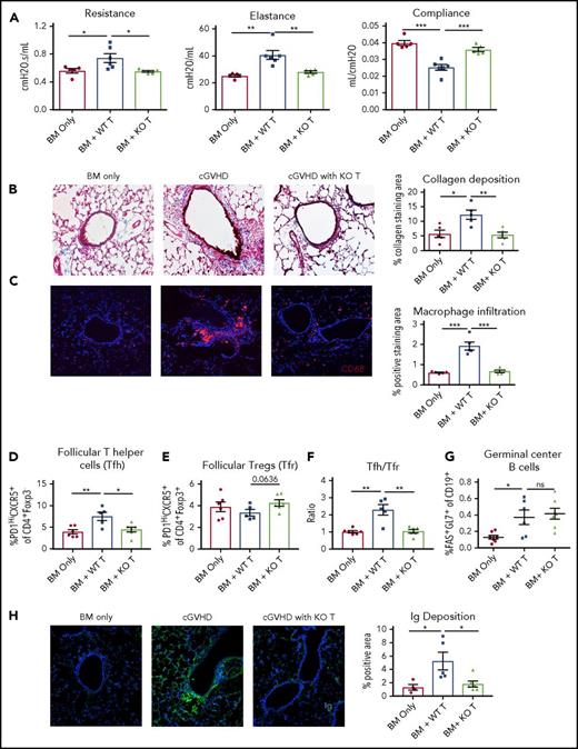 Figure 1. CRK/CRKL−/− T cells do not cause cGVHD-mediated BO. Conditioned B10.BR mice were transplanted with B6 donor BM only or plus 70 000 WT or CRK/CKRL−/− T cells. (A) Pulmonary tests including lung resistance, elastance, and compliance suggest CRK/CKRL−/− donor T cells did not cause cGVHD. (B) Masson’s Trichome staining in lung identified collagen in blue. Quantification of blue areas suggests recipients of CRK/CKRL−/− donor T had significantly lower collagen deposition the WT T-cell recipients. (C) Immunofluorescence staining of macrophage marker CD68 suggests significantly lower macrophage infiltration in the CRK/CRKL−/− T recipients. (D-G) Flow cytometry analysis of cell frequencies in GC reactions including (D) Tfh, (E) Tfr, (F) Tfh/Tfr ratio, and (G) GC B cell. GC analysis suggests CRK/CKRL−/− donor T cells did not induce GC reactions. (H) Immunofluorescence staining of immunoglobulin deposition in the lung. Quantification suggests recipients of CRK/CKRL−/− donor T cells have lower immunoglobulin deposition. Images were taken by Olympus FV1000 upright confocal at ×200 magnification. Data shown are representative of 2 independent experiments with 5 to 8 mice per group. An unpaired Student t test was used when comparing 2 groups. Significance: *P < .05; **P < .01; ***P < .001; ****P < .0001. KO, knockout.