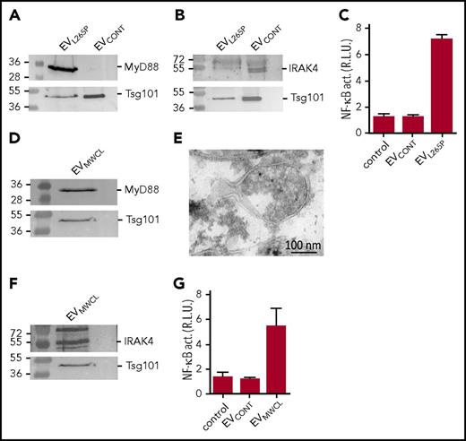 Figure 1. MyD88L265P is secreted from the cells in EVs, which can activate signaling pathway in recipient cells. EVL265P and EVCONT were isolated and (A) MyD88 (protein load 10 μg) and Tsg101 or (B) IRAK4 (protein load 30 μg) and Tsg101 were detected by WB. (C) HEK293 cells expressing luciferase under NF-κB promotor and Renilla luciferase for normalization were stimulated with EVL265P and EVCONT (12 μg/mL) for 24 hours. EVMWCL were isolated and (D) MyD88 (protein load 10 μg) and Tsg101 or (F) IRAK4 (protein load 30 μg) and Tsg101 were detected by WB. (E) EVMWCL were isolated, fixed, and sections were prepared for immune labeling with anti-MyD88 antibody and protein A conjugated to 10-nm gold. Transmission electron microscopy (TEM) was performed. (G) HEK293 cells expressing luciferase under NF-κB promotor and Renilla luciferase for normalization were stimulated with EVMWCL and EVCONT (80 μg/mL) for 24 hours. Negative controls are transfected but unstimulated cells. Dual luciferase tests for NF-κB activity (NF-κB act.) were performed.