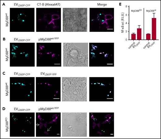Figure 3. MyD88L265P transferred by the EVs forms aggregates with endogenous MyD88 in the recipient cells. (A) EVL265P-CFP (cyan) were isolated and added (5 μg/mL) to the HEK293 cells for 16 hours. Cell membranes were dyed with CT-B Alexa 647 (magenta). (B,D) HEK293 and HEK293 MyD88KO cells were transfected with MyD88wt-YFP (magenta) or (C) left untreated. After 4 hours, EVL265P-CFP (cyan) or EVL265P-YFP (magenta) (both 5 μg/mL) were added for 16 hours. Confocal imaging was performed. Bar for all images, 10 μm. (E) HEK293 and HEK293 MyD88KO cells expressing luciferase under NF-κB promotor and Renilla luciferase for normalization were stimulated with EVL265P (12 μg/mL) for 24 hours. Negative controls are transfected but unstimulated cells. Dual luciferase test for NF-κB activity was performed.
