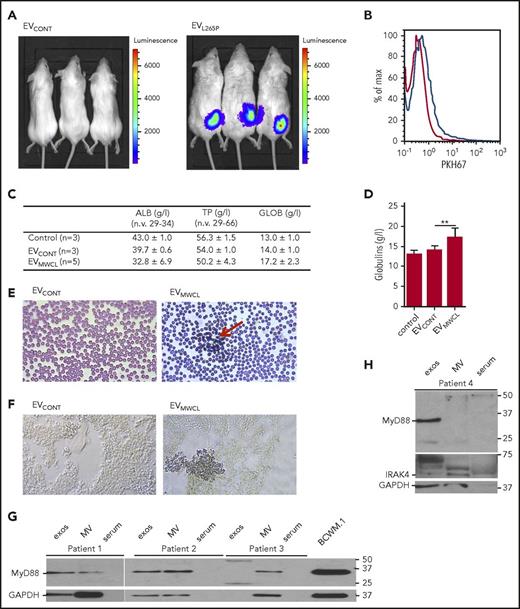 Figure 5. EVs are internalized in vivo and modify the bone marrow microenvironment. (A) HEK293 cells were transfected with luciferase under NF-κB promotor for 24 hours. A total of 2 × 106 cells per mouse were injected s.c. after 30 minutes, EVCONT or EVL265P (150 μg per mouse) were injected IV and incubated for 24 hours. Luciferin was added and, after 10 to 15 minutes, luminescence was measured. PKH67-labeled EVs (100 μg) were injected into bone marrow. After 16 hours, uptake of EVs by bone marrow cells was measured (B). EVCONT or EVMWCL (150 μg) were injected into bone marrow. After 8 days, blood was taken to measure albumin, total protein, and globulin (C-D) concentrations and blood smears (E) for detection of rouleaux formation (red arrow) were prepared. (F) Tissue sections from femurs were prepared and stained for the presence of mast cells (CD40L) (blue). Original magnification ×630 for panels E-F. MVs and exosomes were isolated from bone marrow aspirates of untreated WM patients. MVs, exosomes, serum, and BCWM.1 cell lysate as positive control were used for MyD88 (G) and IRAK4 (H) detection by WB. GAPDH was used as a positive control for EVs and cell lysate.
