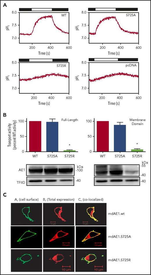 Figure 2. Bicarbonate transport activity and cell surface expression of wild-type, S725R, or S725A mutants in Band 3 or membrane-domain constructs. HEK293 cells were grown on glass coverslips and transiently transfected with complementary DNA plasmids encoding the full length or membrane-domain constructs indicated. (A) Cells were loaded with the pH-sensitive dye, BCECF-AM, and fluorescence was monitored as cells were alternately perfused with chloride-containing Ringer's buffer (black bars) or chloride-free Ringer's buffer (white bars). HCO3− transport rates were monitored by the initial rate of change of intracellular pH (pHi) induced upon switching to chloride-free medium. Perfusion solutions were bubbled with 5% CO2. (B) (Top) HCO3− transport activity of WT and mutant Band 3 or membrane-domain constructs were corrected for background activity of vector-transfected cells, normalized to protein expression level, and expressed as percentage of wild-type rate. Error bars indicate standard errors of the mean (n = 3). *Significant difference in transport rate from WT-Band 3 or membrane-domain construct. (Bottom) Cell lysates from cells used for transport experiments were probed for Band 3 with IVF12 monoclonal antibody and for endogenous transcription factor IID (TFIID) on immunoblots. (C) Immunofluorescence localization of HA-tagged Band 3 membrane domain and S725R and S725A mutants in transfected HEK cells. We transfected 2 µg of mdAE1 WT and mutants by lipofectamine LTX & PLUS for 24 hours. Fixed HEK cells were incubated with subsaturating amounts of mouse anti-HA (1/500 dilution) antibody, followed by anti-mouse immunoglobulin G (IgG) Alexa 488 (green) to detect cell surface AE1. Then cells were washed, permeabilized by Triton X-100, and incubated with a second aliquot of mouse anti-HA antibody (1/500 dilution), followed by anti-mouse IgG-Cy3 (red) antibody to detect total AE1 expression. Cell images were examined using an LSM 510 confocal microscope. Colocalization (yellow) was calculated by Image J JACoP program using Pearson’s and Manders’s coefficients. Column A indicates cell surface mdAE1 (HA-Alexa 488 in green); column B indicates total mdAE1 (HA-cy3 in red); and column C indicates colocalization of cell surface mdAE1 and total mdAE1 (in yellow) on the cell surface. The average Pearson’s coefficients are WT 0.741, S725A 0.661, and S725R 0.419. TFIID, transcription factor IID.