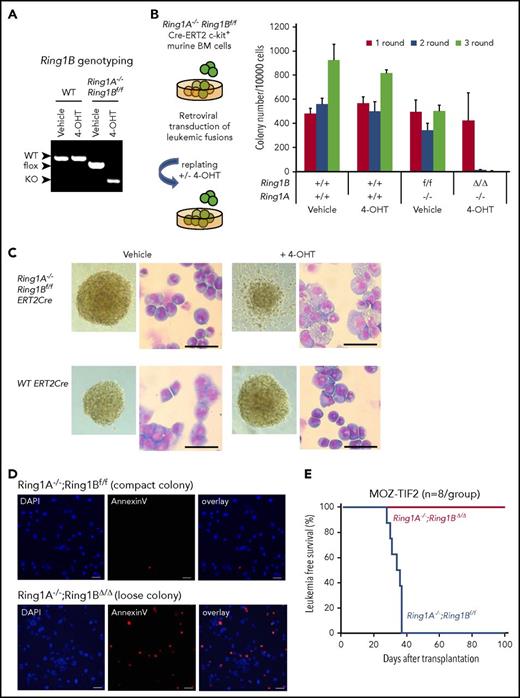 Figure 1. Ring1A/B are crucial for immortalization of MOZ-TIF2–induced AML cells. (A) PCR analysis of genomic Ring1B sequences in Ring1A−/−;Ring1Bf/f;CreERT2 BM cells treated with 4-OHT or ethanol (vehicle control). CreERT2 BM cells are shown as controls. (B) Experimental scheme for colony formation assay (left) and bar chart of the serial replating experiments (right). The graph shows colony number per 10 000 plated cells in each round of plating in methylcellulose media in the presence or absence of 4-OHT. CreERT2 BM cells served as controls. Error bars represent standard deviation (SD) (n = 3). (C) Representative morphology and May-Grünwald Giemsa staining of MOZ-TIF2 colonies cultured with 4-OHT or ethanol for 7 days. Scale bar, 50 μm. (D) Apoptosis analysis by Annexin V staining. After incubation with 4-OHT or vehicle for 72 hours, MOZ-TIF2 leukemic cells were stained with Annexin V Alexa Fluor 594 and attached to glass slides by cytospin. (E) Kaplan-Meier survival curve analysis of tamoxifen or corn oil–treated mice that received a secondary transplant of MOZ-TIF2−transduced Ring1A−/−;Ring1Bf/f;CreERT2 BM cells. Two weeks after transplantation, secondary recipients were intraperitoneally administered tamoxifen or corn oil 3 times per week. KO, knockout