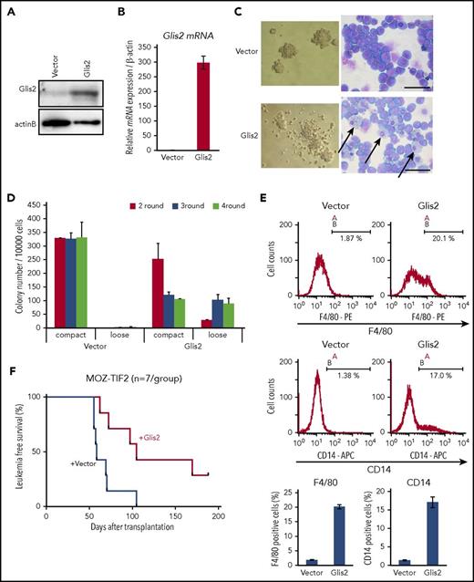 Figure 5. Overexpression of Glis2 induces cell differentiation and suppresses leukemic transformation of cells expressing MOZ-TIF2. (A) Western blot analysis of MOZ-TIF2–expressing leukemic cells transduced with Glis2 or empty vector. MOZ-TIF2 leukemic cells were transfected with GCDNsam-IRES/NGFR-Glis2 or empty vector and then stained with anti-NGFR-APC. NGFR+ cells were magnetically labeled with anti-APC Microbeads and isolated by MACS. (B) Quantitative RT-PCR analysis of Glis2 expression. Error bars represent SD (n = 4). (C) Representative colony morphology and May-Grünwald Giemsa staining of MOZ-TIF2 leukemic cells transduced with Glis2 or empty vector. Scale bar, 50 μm. (D) Serial replating experiments of MOZ-TIF2 leukemic cells transduced with Glis2 or empty vector. Error bars represent SD (n = 3). (E) Flow cytometry analysis of MOZ-TIF2 leukemic cells transduced with Glis2 or empty vector after staining for F4/80 or CD14. Error bars represent SD (n = 3). (F) Kaplan-Meier survival curve analysis of mice that received MOZ-TIF2 leukemic cells transduced with Glis2 or empty vector.