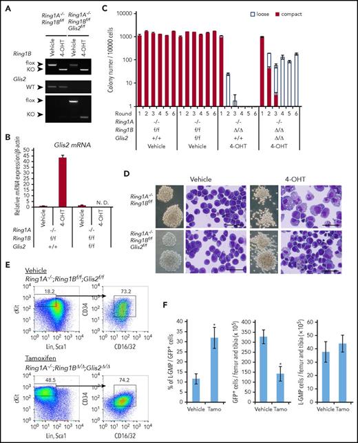 Figure 6. Deletion of Glis2 interferes with differentiation of MOZ-TIF2 leukemic cells induced by deletion of Ring1A/B. (A) PCR analysis of genomic Ring1B and Glis2 sequences in MOZ-TIF2–transduced Ring1A−/−;Ring1Bf/f;CreERT2 and Ring1A−/−;Ring1Bf/f;Glis2/f/f;CreERT2 BM cells in the presence of either 4-OHT or ethanol. (B) Quantitative RT-PCR analysis of Glis2 expression in Ring1A−/−;Ring1Bf/f;CreERT2 and Ring1A−/−;Ring1Bf/f;Glis2/f/f;CreERT2 BM cells transduced with MOZ-TIF2. RNA was extracted from cells incubated with 4-OHT for 48 hours. Error bars represent SD (n = 4). (C) Serial replating experiments of MOZ-TIF2–transduced Ring1A−/−;Ring1Bf/f;CreERT2 and Ring1A−/−;Ring1Bf/f;Glis2/f/f;CreERT2 BM cells in the presence of either 4-OHT or ethanol. Error bars represent SD (n = 3). (D) Representative colony morphology and May-Grünwald Giemsa staining of cells from first-round colonies formed by MOZ-TIF2–transduced Ring1A−/−;Ring1Bf/f;CreERT2 and Ring1A−/−;Ring1Bf/f;Glis2/f/f;CreERT2 BM cells in the presence of either 4-OHT or ethanol. Scale bar, 50 μm. (E,F) Secondary recipients of AML mice transplanted with MOZ-TIF2–transduced Ring1A−/−;Ring1Bf/f;Glis2/f/f;CreERT2 BM cells were treated with tamoxifen or corn oil (vehicle) for 5 consecutive days when the proportion of GFP+ MNCs in peripheral blood reached 50%. On the day following the last treatment, BM-MNCs were harvested and subjected to (E) flow cytometric analyses and (F) quantitation of L-GMP cells (mean ± SD, *P < .01, n = 6).