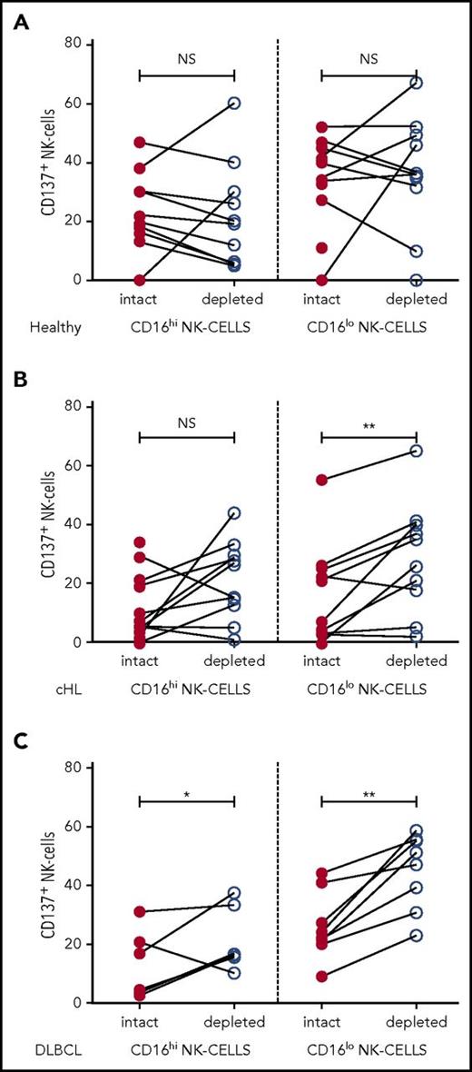 Figure 4. NK-cell activation is inhibited by immunosuppressive monocyte/macrophages in patient samples ex vivo. Patient PBMC, with or without monocyte depletion, was co-incubated with K562 and CD137 quantified on CD16+/− CD56+NK-cell subsets in (A) healthy participants. (B) patients with cHL, and (C) patients with DLBCL.