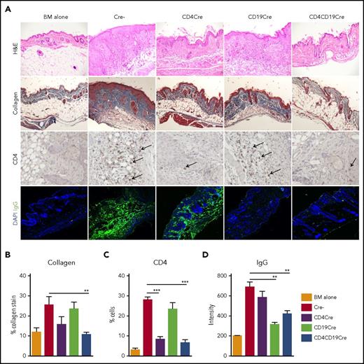 Figure 2. miR-17-92 regulates CD4-T cell infiltration and antibody deposition in skin. BMT was performed as described in Figure 1. Recipient skin was harvested at day 60 after transplantation and processed for hematoxylin and eosin (H&E), Masson trichrome stain for collagen (blue area), immunohistochemistry staining for CD4 (brown), and immunofluorescence staining for IgG (green area) as described in supplemental Methods. (A) Representative images from 3 individual experiments are shown and black arrows point to CD4+ cells (original magnification ×200). (B) Percentage of area with collagen deposition was analyzed using ImageJ. (C) CD4 cell infiltration was quantified by calculating the average ratio of CD4+ cells to total cells in a 100-mm2 field of view under microscope from 3 representative fields. (D) IgG intensity in skin was analyzed using ImageJ software and mean fluorescence intensities are shown from 3 representative fields. N = 4-5 mice per group. **P < .01; ***P < .001. DAPI, 4′,6-diamidino-2-phenylindole.