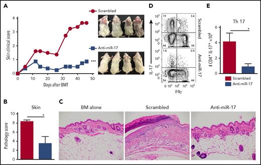 Figure 7. Anti–miR-17 treatment alleviates skin damage in a sclerodermatous cGVHD model. BALB/c mice were lethally irradiated and transferred with 5 × 106 TCD-BM plus 5 × 106 splenocytes from B10.D2 mice. Recipient mice were treated with anti–miR-17 or scrambled at a loading dose 25 mg/kg at day 0 followed by 5 mg/kg twice weekly up to day 25 after BMT. (A) The clinical scores of the recipient skin with macroscopic photos are shown 45 days after BMT. Pathology scores (B) and H&E staining (original magnification ×200) (C) in recipient skin are shown at 60 days after BMT. Representative flow figures (D) and average numbers (E) of IL-17+ cells on gated donor Ly9.1−CD4+ live cells in skin draining lymph nodes are shown at day 60 after BMT. N = 7 mice per group. *P < .05; ***P < .001.
