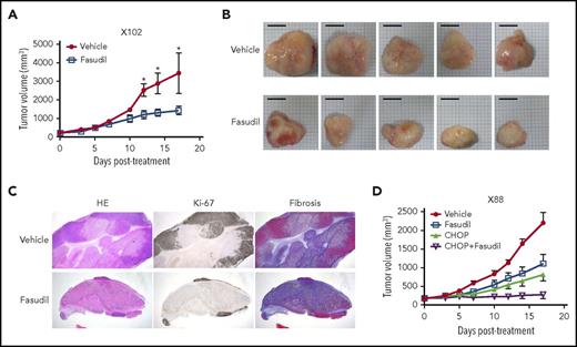 Figure 5. In vivo efficacy of a ROCK inhibitor, fasudil, in EBV+-DLBL mouse models. (A-B) The efficacy of a ROCK inhibitor, fasudil, in EBV+-DLBL mouse models with the RHPN2 I300M mutation (X102). Mice were treated with fasudil (50 mg/kg/day) or vehicle for 17 days (n = 5). Average tumor sizes for each group were plotted (A), and representative tumors after treatment are shown (B). Asterisks indicate statistically significant differences (*P < .05) between vehicle- and fasudil-treated groups. Scale bar, 10 mm. (C) Immunohistological analysis of fasudil-treated residual tumors in EBV+-DLBL PDX models. Microscopic examination (hematoxylin and eosin stain, 1.25×) showed decreased numbers of viable cells highlighted by Ki-67 labeling and increased necrosis with fibrosis. Fibrosis was determined by collagen staining. HE, hematoxylin and eosin stain. (D) The synergistic effect of fasudil and CHOP in EBV+-DLBL mouse models with the RHPN2 V73M mutation (X88). Mice were treated with fasudil (50 mg/kg/day), CHOP (cyclophosphamide, 30 mg/kg, day 1; hydroxydoxorubicin, 2.475 mg/kg, day 1; vincristine, 0.375 mg/kg, day 1; and prednisone, 0.15 mg/kg, day 1-5), or a combination of fasudil and CHOP for 17 days (n = 5), and average tumor sizes for each group were plotted.
