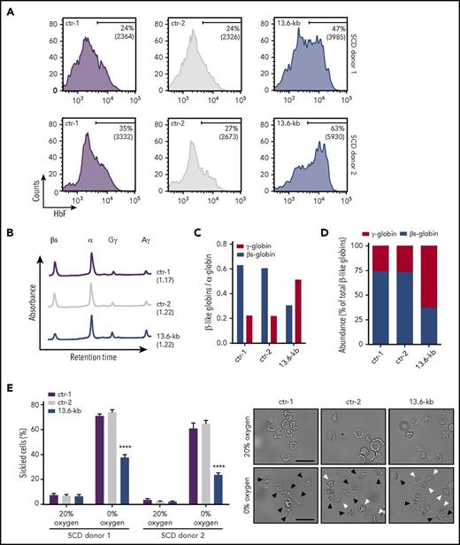 Figure 6. CRISPR/Cas9-mediated induction of HbF expression improves the RBC sickling phenotype. Bone marrow (donor 1) and mobilized (donor 2) SCD CD34+ cells were transfected with plasmids carrying Cas9-GFP and gRNAs targeting the 13.6-kb region. Upon FACS-sorting, GFP+ genome-edited (13.6-kb) HSPCs were terminally differentiated in RBCs using a 3-phase liquid erythroid culture system.24 GFP+ cells from Cas9-only samples (ctr-1) and GFP− cells from Cas9+gRNAs cultures (ctr-2) were used as controls. (A) FACS analysis of HbF expression in control and genome-edited RBCs. The fraction of F-cells and the MFI of HbF immunostaining (in brackets) are displayed in the histograms. (B) RP-HPLC profiles of control and genome-edited RBCs (donor 1). The ratio of α chains to non–α chains is indicated in brackets. (C-D) Quantification of γ (Aγ+Gγ)-globins and sickle β-globin protein levels by RP-HPLC. Globin chain expression was normalized to α-globin (C). Relative abundance of β-like chains was calculated as fraction of total β-like (β + γ) globins (D). (E) In vitro sickling assay measuring the proportion of sickled RBCs under hypoxic conditions (0% O2) (left panel). The percentage of sickled cells was calculated as: (sickled RBC count)/(total RBC count). At least 300 enucleated cells and 10 fields per time point were analyzed for each sample. Data are expressed as mean ± SEM. ****P < .0001 (2-way analysis of variance, Tukey’s multiple comparisons test vs ctr-1 and ctr-2). Representative microscopy images of RBCs before (0 minutes) and after (60 minutes) deoxygenation are shown in the right panel. Black and white arrowheads indicate sickled cells and nonsickled cells, respectively, under hypoxic conditions. Original magnification ×40. Scale bars, 50 µm.