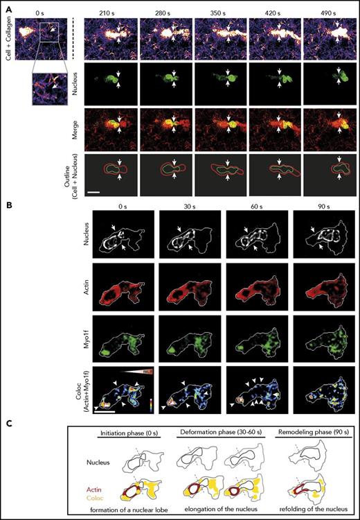Figure 5. Live cell imaging of nuclear deformation and dynamics of Actin and Myo1f localization during migration in 3D environments. Analysis of 3D migration in a 1.5 mg/mL collagen gel toward an fMLP (100 nM) gradient was performed with dHL-60-EGFP-Myo1f cells or isolated human neutrophils. (A) Live cell imaging of the human neutrophil nucleus (labeled with Hoechst 5 µM, green) and the collagen meshwork (fire and red) using confocal reflection/fluorescence microscopy. Serial images of a movie of a representative neutrophil migrating through a meshwork of collagen fibers at indicated time points. Confocal reflection images demonstrate the architecture of the collagen gel as well as the neutrophil body (fire and red). Fluorescence images depict the shape of the nucleus during migration within a collagen gel (green). Merge (yellow) shows the reflection image (red) and the nucleus (green). Schematic outline of the shape of the cell (red) and the nucleus (green) while the neutrophil squeezes through a narrow pore. Arrows indicate the pore (white). Neutrophil localization is normalized to the position of the pore. Scale bar, 10 µm. The cell is representative for a total of 12 cells from 3 independent experiments. (B) Live cell imaging of a migrating dHL-60-EGFP-Myo1f cell using spinning-disk confocal microscopy. Pseudo-colored images demonstrate the morphology of the nucleus (gray) of dHL-60 EGFP-Myo1f cells, the subcellular localization of Actin (red) and Myo1f (green), as well as the colocalization of Actin and Myo1f (arrowheads). Arrows indicate constriction site. Scale bar, 10 µm. Color scales, heat map. Triangle indicates orientation of fMLP gradient. The cell is representative for a total of 9 cells from 3 independent experiments. (C) Schematic outline of the nuclear morphology (black), localization of Actin (red) and Myo1f (green), and colocalization of Actin and Myo1f (yellow) during 3D migration at indicated time points. The border of the cell body is depicted in gray.