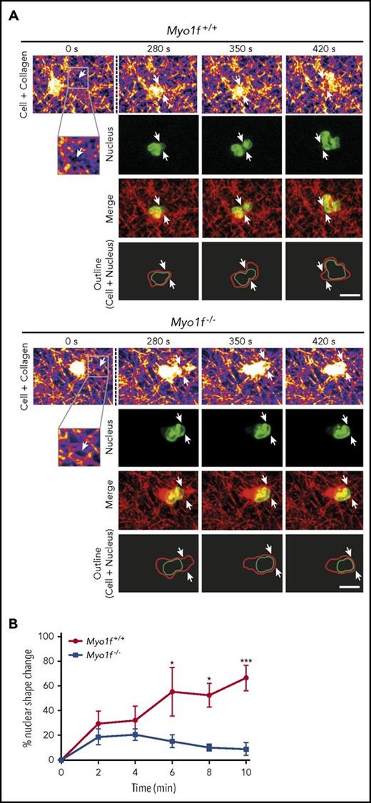 Figure 6. Myo1f−/−nuclei failed to deform during 3D migration. Myo1f+/+ and Myo1f−/− neutrophils migrating in a 1.5 mg/mL collagen gel toward a CXCL1 (100 ng/mL) gradient. (A) Live cell imaging of the neutrophil nucleus (labeled with Hoechst 5 µM, green) and the collagen meshwork (fire and red) using confocal reflection/fluorescence microscopy. Serial images of movies of representative neutrophils migrating through a meshwork of collagen fibers at indicated time points. Confocal reflection images demonstrate the architecture of the collagen gel as well as the neutrophil body (fire and red). Fluorescence images depict the shape of the nucleus during migration within a collagen gel (green). Merge (yellow) shows the reflection image (red) and the nucleus (green). Schematic outline of the shape of the cell (red) and the nucleus (green) while the neutrophils squeeze through narrow pores. Arrows indicate the pores (white). Neutrophil localization is normalized to the position of the pore. Scale bar, 10 µm. The cells are representative for a total of 9 cells from 3 independent experiments. (B) Percentage of nuclear shape change during neutrophil 3D migration at indicated time points based on individual nuclear shape of each neutrophil during the observation period of 30 minutes using spinning-disk confocal microscopy. Time point 0 minutes represents the most spherical nuclear morphology of each individual cell that was observed for 10 minutes thereafter. n = 3 independent experiments; mean ± SEM; *P < .05; ***P < .001 (2-way ANOVA, Sidak multiple comparison test).