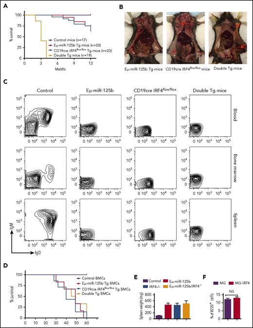 Figure 6. miR-125b–induced B-cell leukemia is accelerated in IRF4-deficient mice, and enforced expression of IRF4 inhibits miR-125b–induced development of spontaneous B-cell cancers in mice. (A) Survival curve of Eμ/miR-125b-Tg mice, CD19cre IRF4flox/flox Tg mice, double-Tg mice, and control mice. The genotypes and number of mice in each group are indicated on the plot. (B) Some Tg mice developed lymphoma. Lymphomas are shown at the superficial cervical or inguinal lymph node sites by red arrows. (C) Representative flow cytometric analysis of leukemic B cells in the blood, bone marrow, and spleen of moribund Eμ/miR-125b, CD19cre IRF4flox/flox and double-Tg mice. (D) Survival curve of the secondary recipient mice transplanted with bone marrow cells from moribund Eμ/miR-125b-Tg mice, CD19cre IRF4flox/flox Tg mice, double-Tg mice, and control mice (n = 6 mice per group). (E) Spleen weight of the secondary recipients described in panel D. (F) Frequency of bone marrow B cells (B220+) in mice receiving Eμ/miR-125b-Tg donor cells that were transduced with either an IRF4-expressing vector or a control vector. NS, not significant.