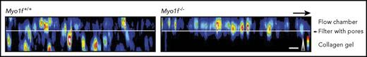 Under physiological flow conditions (1 dyne/cm2), murine neutrophils attach to membranes coated with recombinant murine ICAM-1 (rmICAM-1) and rmP-selectin and successfully transmigrate through pores into collagen gel containing a chemoattractant molecule. In contrast, Myo1f-deficient neutrophils are mostly unable to transmigrate, and the majority of neutrophils are found within the flow chamber or stuck within the pores. This figure provides a robust demonstration of the need for Myo1f for neutrophils to migrate through 3D environments in vitro and an explanation for the failure of Myo1f-deficient neutrophils to accumulate into sites of inflammation in vivo. See the complete Figure 3 in the article by Salvermoser et al that begins on page 1887.