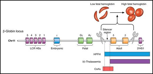 Induction of HbF by a genome editing-based deletion can ameliorate SCD. This illustration depicts the human β-globin locus on chromosome 11 (chr11) with a 3.5-kb silencer region upstream of the δ-globin gene. Typical deletions implicated in HPFH and δβ-thalassemia, as well as the Corfu thalassemia deletion, are illustrated below the locus. The schematic shows that disruption of the silencer region, in addition to the δ- and β-globin genes, using genome editing tools (depicted as scissors) can lead to a robust elevation in HbF production and ameliorate the SCD phenotype. HSs, hypersensitivity sites; 3′HS1, downstream hypersensitivity site; LCR, locus control region. Professional illustration by Patrick Lane, ScEYEnce Studios.