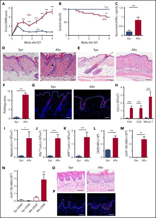 Figure 1. Hair follicles and rete-like prominences in the lingual epithelium are damaged in GVHD. Lethally irradiated B6 mice were transplanted with 20 × 106 G-CSF–mobilized splenocytes from syngeneic (Syn) B6 or allogeneic (Allo) BALB/c mice on day 0, except for (G,P) using B6-Lck-Cre × R26tdTomato and for (K) using B6-Il17aCre × R26eYFP as donors. (A) Clinical GVHD scores from 3 experiments (n = 11 per group). (B) Survival curves from 6 independent experiments (n = 20 per group). (C) Serum levels of IFN-γ on day +14 after SCT from 3 independent experiments (n = 8-10 per group). (D-F) The back skins were harvested on day +14 (D) and +28 (E-F) after SCT. The representative images of hematoxylin and eosin (H&E) staining (D-E) and pathological GVHD scores (F) from 3 independent experiments. The arrowhead indicates dermal epidermal detachment. (G) Immunofluorescent images of tdTomato+ donor T cells (red) with 4′,6-diamidino-2-phenylindole (DAPI) nuclear staining (blue) in the skin harvested on day +10 after SCT. Dashed line shows the epidermal-dermal junction. (H-L) Flow cytometric analysis of skin-infiltrating cells on day +14 after SCT. The absolute numbers of donor T cells (H), CD11b+ myeloid cells (I), IFN-γ+ T cells (J), IL-17 eYFP+ T cells (K), and mean fluorescence intensity (MFI) of CXCR3 on T cells (L) from 2 experiments (n = 8-10 per group). (M-N) Total RNA was extracted from the whole skin (M) or purified CD45+ cells and CD45− cells from the back skin (N) on day +14 after SCT and the expression of Cxcl9 was evaluated by Q-PCR (n = 8-10 per group from 2 independent experiments). H&E staining (O) and immunofluorescent staining of tdTomato+ donor T cells (red) with DAPI (blue) staining (P) of lingual samples harvested on day +7 after SCT. Dashed line shows the junction of epithelium and lamina propria. Original magnification ×20 (D,G,O,P) and ×10 (E). Scale bar, 50 μm. The Mann-Whitney U test or 1-way ANOVA followed by the Tukey posttest was used to compare the data (*P < .05; **P < .01; ***P < .005). Data represent the mean ± SEM. rRNA, ribosomal RNA.