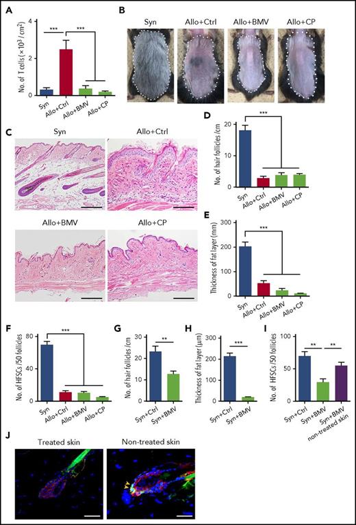 Figure 3. Topical corticosteroids damage Lgr5+ HFSCs and induce loss of hair follicles and fat-layer atrophy in the skin. (A-J) Lethally irradiated B6 or B6-Lgr5EGFP-cre/ER mice were transplanted as in Figure 1, followed by daily administration of control Vaseline (Ctrl), betamethasone valerate ointment 0.12% (BMV), or clobetasol propionate ointment 0.05% (CP) on their shaved back skin from day +1 after SCT. (A) Numbers of infiltrating donor T cells on day +14 after SCT from 2 independent experiments (n = 8 per group). Representative macroscopic images (B), H&E staining of the skin sections (C), numbers of hair follicles (D), and thickness of fat layer (E) in treated skin on day +50 after SCT. Data from 2 independent experiments were combined (n = 6-7 per group). The area surrounded by a dashed line shows treated skin with each ointment. Original magnification ×10. Scale bar, 100 μm. (F) EGFP+ cells in 50 follicles of treated skin on day +14 after SCT from 2 independent experiments (n = 6-7 per group). (G-J) Lethally irradiated B6 or B6-Lgr5EGFP-cre/ER mice were transplanted with 5 × 106 bone marrow cells and 5 × 106 splenocytes from syngeneic B6 mice and administrated daily with each ointment onto back skin for 3 weeks after SCT. Numbers of hair follicles (G) (n = 10 per group), thickness of fat layer (H) (n = 10 per group), and numbers of EGFP+ cells in 50 follicles (I) (n = 7 per group) from 2 independent experiments were combined. (J) Representative immunofluorescent images of EGFP (green), CK15 (red), and DAPI (blue) of the treated skin and nontreated skin of the syngeneic animal. Original magnification ×40. Scale bar, 50 μm. One-way ANOVA followed by the Tukey posttest was used to compare the data (***P < .005; **P < .01). Data represent the mean ± SEM.