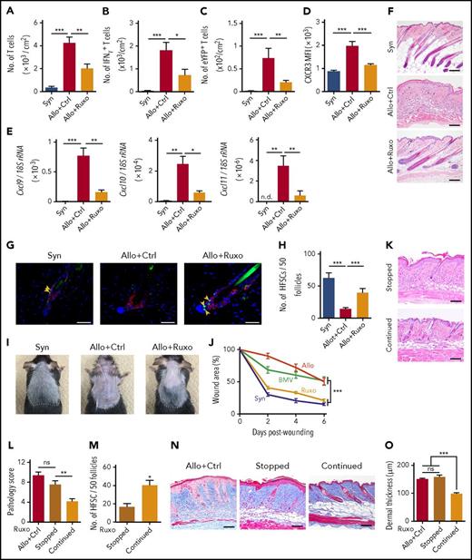 Figure 4. Topical ruxolitinib ameliorates skin GVHD, protects Lgr5+ HFSCs against skin GVHD, and promotes hair regeneration and wound healing. B6 or B6-Lgr5EGFP-cre/ER mice were transplanted as in Figure 1. (A-J) Recipients were treated daily with Vaseline (Ctrl) or ruxolitinib (Ruxo) ointment on their shaved back skin from day +1 after SCT. (A-E) Numbers of T cells (A), IFN-γ+ T cells (B), IL-17-eYFP+ T cells (C) and MFI of CXCR3 on T cells (D), and expression levels of Cxcl9, Cxcl10, and Cxcl11 (E) measured by Q-PCR on day +14. Data from 3 independent experiments (n = 6-10 per group). (F) H&E staining of skin samples on day +28 after SCT. Original magnification ×10. Scale bar, 100 μm. (G) Immunofluorescent staining of the skin samples on day +14 after SCT with EGFP (green), CK15 (red), and DAPI (blue). Original magnification ×40. Scale bar, 50 μm. (H) Numbers of EGFP+ cells per 50 follicles from 2 independent experiments (n = 6-7 per group). (I) Macroscopic images of hair regeneration in the treated skin on day +35 after SCT. The treated areas are surrounded by dashed lines. (J) Mice were treated with each ointment from day +1 to day +21 after SCT. Full-thickness wounds were made on the back skin of recipient mice on day +21. Wound areas of syngeneic (Syn; blue), allogeneic control (Allo; red), allogeneic plus BMV (green), and allogeneic plus ruxolitinib (Ruxo; orange) from 2 independent experiments. (K-O) Ruxolitinib ointment was stopped on day +15 (Stopped) or continued thereafter (Continued). The representative images of H&E staining (K; scale bar, 100 μm), pathology skin GVHD scores (L) and the numbers of Lgr5+ HFSCs in the treated skin (M) on day +21 after allogeneic SCT from 2 independent experiments (n = 5-6 per group) were shown. Representative images of Masson trichrome staining (N; scale bar, 100 μm) and dermal thickness of treated skin (O; n = 6-7 per group) on day +35 from 2 independent experiments. The Mann-Whitney U test or 1-way ANOVA followed by Tukey posttest was used to compare the data (*P < .05; **P < .01; ***P < .005). Data represent the mean ± SEM.