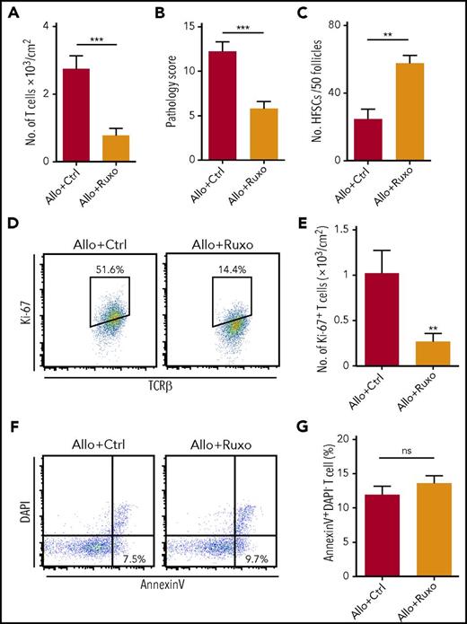 Figure 5. Therapeutic administration of topical ruxolitinib ameliorates established skin GVHD and protects HFSCs. (A-G) Lethally irradiated B6 mice were transplanted as in Figure 1. Recipient mice were treated with ruxolitinib ointment from day +10 after allogeneic SCT. Number of donor T cells (A), pathological skin GVHD scores (B) (n = 7-9 per group), and numbers of EGFP+ cells in 50 follicles on day +21 (C; n = 6 per group). (D-G) Ki-67 staining (D-E) and Annexin V assay (F-G) of donor T cells from the treated skin were performed on day +15 after allogeneic SCT (n = 8-9 per group). Data from 2 independent experiments were combined and shown as the mean ± SEM. The Mann-Whitney U test was used to compare the data (*P < .05; **P < .01; ***P < .005). ns, not significant; TCR, T-cell receptor.