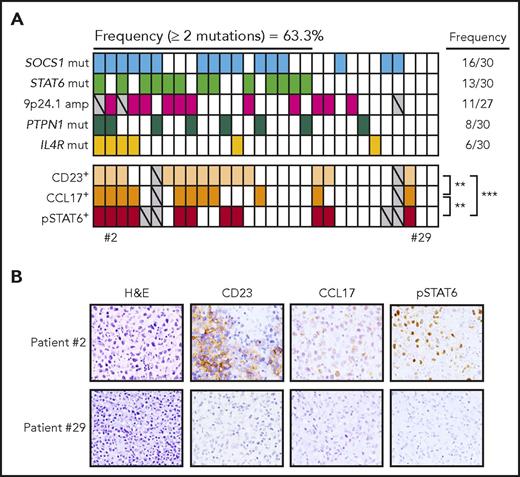 Figure 6. Aberrations in the JAK-STAT pathway in PMBCL. The frequency and presence of aberrations affecting 5 genes (SOCS1, STAT6, JAK2, PTPN1, IL4R) are displayed in the first 5 rows for 30 PMBCL patients. Each column represents a patient, and rows are ordered by the presence of mutations from the most to the least frequently mutated gene. For each patient, IHC analysis of CD23, CCL17, and pSTAT6 are displayed (staining is considered positive when the percentage of positive cells is ≥10%); significant correlation was evaluated using 2-sided Fisher exact test. **P < .01; ***P < .001. Gray, data not evaluable. (B) Representative IHC sections stained with H&E, CD23, pSTAT6, and CCL17. Images were acquired using an Eclipse E600 microscope, DS-F1 camera, and DS-L2 acquisition software (Nikon); original magnification ×40; numerical aperture of objective lenses, 0.75.