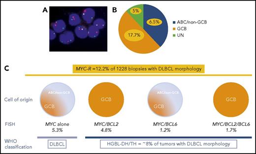(A) FISH for MYC using MYC break-apart probe in DLBCL. (B) In the study of Scott et al, GCB, ABC, and unclassified DLBCLs represent 50%, 38%, and 12% of all DLBCLs, respectively. MYC-R DLBCL (yellow) accounts for 17.7% of GCB, 6.5% of ABC, and 5% of unclassified DLBCLs. (C) MYC-R was detected in 12.2% of cases with DLBCL morphology, including 5.3% of DLBCLs with MYC sole rearrangement; 4.2% of MYC/BCL2 HGBL-DH; 1.2% of MYC/BCL6 HGBL-DH; and 1.7% of MYC/BCL2/BCL6 HGBL-TH. Overall, HGBL-DH/TH represents ∼8% of cases with DLBCL morphology.