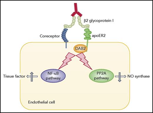 Molecular basis of the activation of endothelial cells by anti–β2 glycoprotein I antibodies. This scheme includes those processes described in the literature that have been confirmed in animal models of APS. PP2A, protein phosphatase 2A.