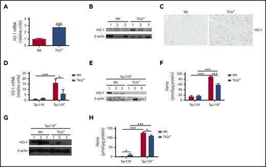 Figure 1. HO-1 expression is increased in the liver and decreased in Ter119+ cells of the bone marrow and the spleen of Th3/+ mice. (A) Quantitative reverse transcription polymerase chain reaction (qRT-PCR) analysis of HO-1 mRNA expression in the liver of Wt and Th3/+ mice. The results are presented as fold of change relative to the Wt sample (n = 3). (B) Western blot analysis of HO-1 protein expression in the liver of Wt and Th3/+ mice (n = 3). (C) Representative pictures (20× magnification; scale bar, 200 µM) of immunohistochemical staining against HO-1 in the liver from Wt and Th3/+ mice. (D) qRT-PCR analysis of HO-1 mRNA expression in Ter119− and Ter119+ cell populations isolated from the bone marrow of Wt and Th3/+ mice. The results are presented as fold change relative to Wt Ter119− cells (n = 3). (E) Western blot analysis of HO-1 protein expression in Ter119+ bone marrow samples (n = 3). (F) Total heme levels in Ter119− and Ter119+ cells isolated from the bone marrow of Wt and Th3/+ mice (n = 6). (G) Western blot analysis of HO-1 protein expression in Ter119+ spleen samples (n = 3). (H) Total heme levels in Ter119− and Ter119+ cells isolated from the spleen of Wt and Th3/+ mice (n = 6). *P < .05, ***P < .001.