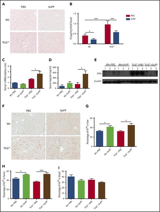 Figure 3. SnPP injections decrease nonheme iron levels and heme-iron recycling in the liver of Th3/+ mice. (A) Representative pictures (20× magnification; scale bar, 200 µM) of Perls’ Prussian blue staining in Wt and Th3/+ mice injected with either PBS or SnPP. (B) Ferrozine assay of nonheme iron content in the liver isolated from mice treated as follows: Wt + PBS (n = 6), Wt + SnPP (n = 6), Th3/+ + PBS (n = 5), or Th3/+ + SnPP (n = 5). (C) qRT-PCR analysis of HAMP mRNA expression in the liver of Wt and Th3/+ mice injected with either PBS or SnPP (n = 3). (D) Enzyme-linked immunosorbent assay of hepcidin in the serum of Wt and Th3/+ mice injected with either PBS or SnPP (n = 6). (E) Western blot analysis of FPN protein expression in samples isolated from the liver of Wt and Th3/+ mice injected with either PBS or SnPP (n = 3). (F) Representative images (20× magnification; scale bar, 200 µM) of immunohistochemical staining of FPN in livers from Wt or Th3/+ mice injected with PBS or SnPP. (G) Percentage of 59Fe in the liver of Wt and Th3/+ mice injected with either PBS or SnPP (n = 3). (H) Percentage of 59Fe in the heme fraction in the liver of Wt and Th3/+ mice injected with either PBS or SnPP (n = 3) (I) Percentage of 59Fe in total peripheral blood of Wt and Th3/+ mice injected with either PBS or SnPP (n = 3). Percentage was calculated based on the total 59Fe recovered for each mouse. *P < .05, ***P < .001.