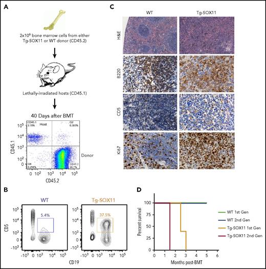 Figure 4. BMT from Tg-SOX11 donors models lethal MCL. (A) Flow cytometry tracking engraftment of CD45.2 donor bone marrow in the peripheral blood of CD45.1-recipient mice. (B) CD5+CD19+ cell fraction in splenocytes of sublethally irradiated recipients of bone marrow from Eμ-SOX11-EGFP donors as compared with recipients of bone marrow from WT donors. (C) Pathological analysis of the spleen in recipient mice transplanted with BM from Eμ-SOX11-EGFP donors. (D) Kaplan-Meier survival curves for recipient mice (1st gen) transplanted once with bone marrow from Tg-SOX11 vs WT donors and upon second serial BMT (2nd gen); N = 5/group.