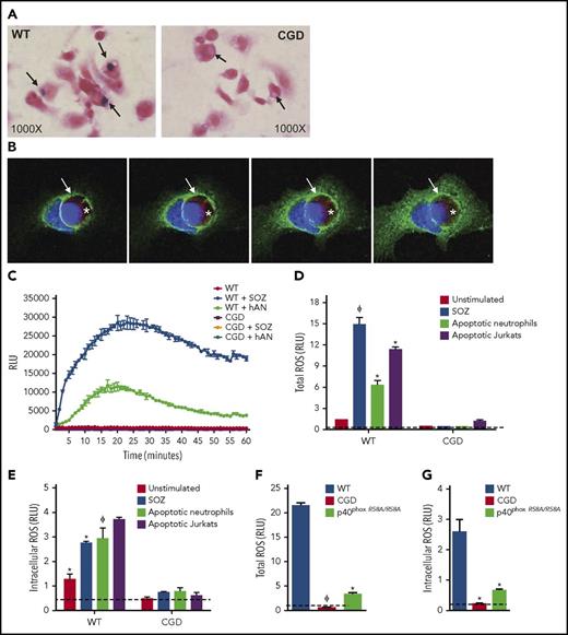 Figure 1. Efferocytosis leads to NADPH oxidase activation and oxidant production in mouse peritoneal macrophages. (A) WT and CGD PEMs plated on chamber slides were fed hANs at 1:5 (PEMs to hANs) in the presence of NBT for 30 minutes. Black arrows point to efferosomes. NBT oxidation by ROS leads to purple formazan deposits, observed in WT PEM efferosomes, whereas formazan-negative cytoplasmic inclusions can be observed in CGD PEMs. Images were acquired using 100× oil lens. (B) hANs were labeled with Cell Tracker Red (denoted with a white asterisk) from an X-CGD patient were fed to WT mouse PEMs for 20 minutes. gp91phox recruitment (green ring; white arrow) and 4′,6-diamidino-2-phenylindole (DAPI) nuclear staining (blue) was assessed by confocal microscopy. Images were acquired in a confocal microscope using 100× oil lens. Images from left to right denote confocal images taken at different planes (top to bottom). (C) PEMs from WT and CGD mice were stimulated with hANs, serum-opsonized zymosan (SOZ), and ROS production monitored using lucigenin-elicited chemiluminescence. Response kinetics are shown in panel C as mean ± SD from 1 of 5 experiments. Total integrated relative light units per second (RLU) over 1 hour from duplicate wells of WT or CGD PEMs after stimulation with hANs, apoptotic Jurkat cells, or SOZ from 3 independent experiments are shown for (D) total ROS and (E) intracellular ROS. (F) Total and (G) intracellular ROS production in WT and p40phoxR58A/R58A PEMs after addition of hANs. Statistical differences between groups were calculated using 2-way analysis of variance (ANOVA) with Bonferroni posttest correction. *P < .05; ϕP < .01.