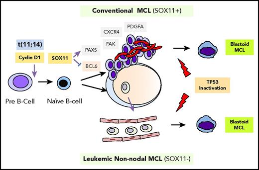 Figure 6. MCL pathogenesis and molecular subtypes. MCL primary oncogenic event is the t(11;14) leading to CCND1 overexpression. The differential expression of SOX11 seems to be a relevant factor defining the 2 molecular subtypes. SOX11 expression represses BCL6 that may prevent cells from entering the germinal center. These cells carry unmutated IGHV and are genetically unstable. SOX11 may block the terminal B-cell differentiation of cells by forcing PAX5 expression and promote tumor cell growth, migration, and homing to lymph nodes via activation of the CXCR4/FAK/PI3K/AKT axis. SOX11− MCL cells enter the germinal center, carry mutated IGHV, and are genetically stable. The SOX11− tumor cells have very low invasive potential and remain in the blood as leukemic disease. Both MCL subtypes, conventional and leukemic nonnodal, may acquire additional genetic events such as TP53 mutations than promote progression to aggressive variants.
