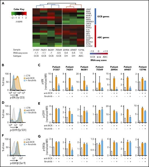 Figure 1. Analysis of BCR signaling in primary DLBCL patient samples. (A) Classification of 7 DLBCL primary samples based on their expression profile. The heat map shows the expression (z-score) of 8 GCB and 11 ABC genes in the indicated samples. The computed RNA-seq score distinguishes between GCB, ABC DLBCL, or DH. (B,D,F) Representative flow cytometry analysis to determine the phosphorylation of BTK (B, patient 69487), CD19 (D, patient 20954), and GSK3β (F, patient 20954) in purified lymphoma cells stimulated with anti-BCR (orange) or treated with ibrutinib (blue). Unstimulated cells were used as control (gray). (C,E,G) Quantification of the median fluorescence values (MFIs) of pBTK (Tyr223) (C), pCD19 (Tyr 531) (E), and pGSK3β (Ser9) (G) in the indicated patients normalized to the stained, unstimulated control. Data are represented as bar plots corresponding to the mean ± standard deviation (SD) of 3 replicates. Significant changes between stimulated cells (orange bars) and stimulated cells treated with ibrutinib (blue bars) are labeled with an asterisk (uncorrected P ≤ .05). Unlabeled bars indicate not statistically significant changes.